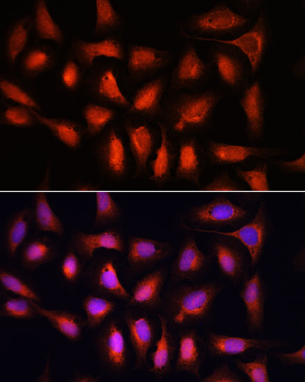 IRF1 Rabbit Polyclonal Antibody