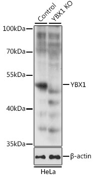 YBX1 Polyclonal Antibody