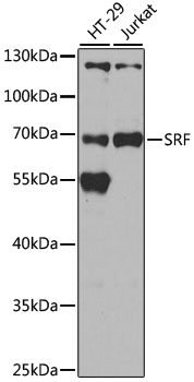 SRF Rabbit Polyclonal Antibody