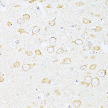 SQSTM1 / p62 Polyclonal Antibody