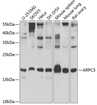 ARPC3 Polyclonal Antibody