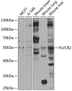 FLVCR2 Polyclonal Antibody