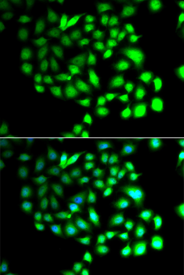 TCEAL8 Rabbit Polyclonal Antibody