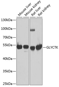 GLYCTK Polyclonal Antibody