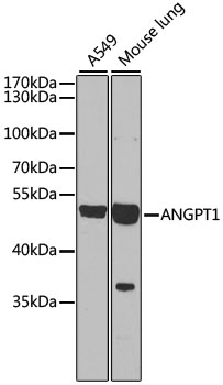 ANGPT1 Rabbit Polyclonal Antibody