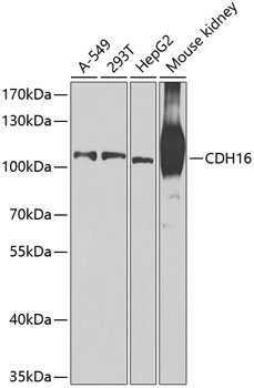 CDH16 Rabbit Polyclonal Antibody