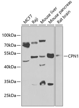 CPN1 Polyclonal Antibody