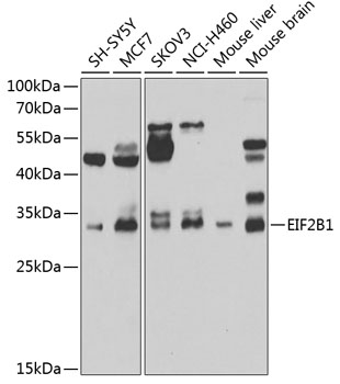 EIF2B1 Polyclonal Antibody