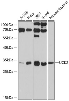 UCK2 Rabbit Polyclonal Antibody