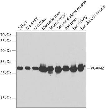 PGAM2 Polyclonal Antibody