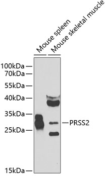 PRSS2 Polyclonal Antibody