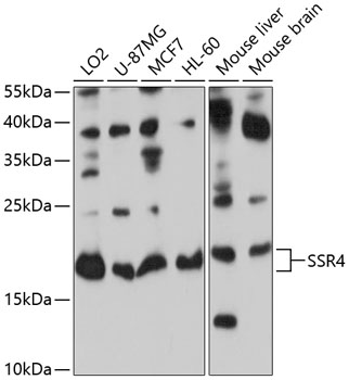 SSR4 Polyclonal Antibody