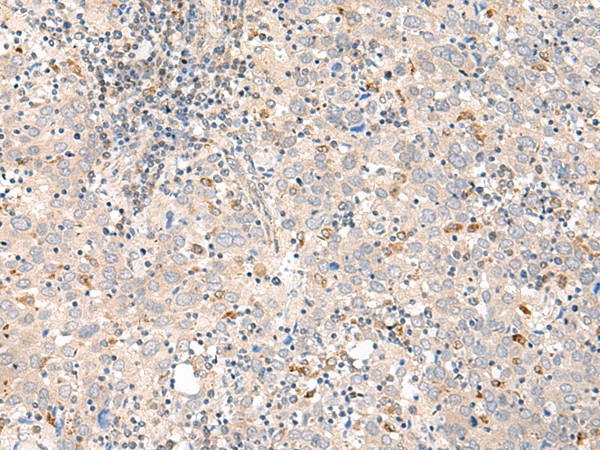 GALR1 Antibody