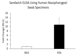 Anti-Nucleocapsid (N) Rabbit Monoclonal Antibody