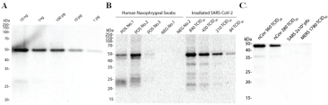 Human Nasopharyngeal Swab Lysates