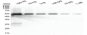 SARS-COV-2 Nucleocapsid (N) Protein