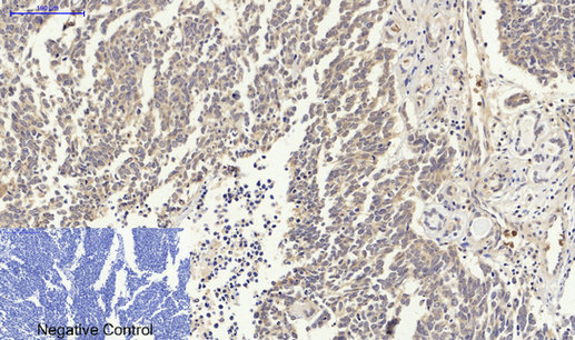 p53(Ab-15) Antibody