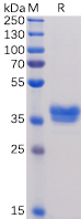 Human BCMA Protein, mFc Tag