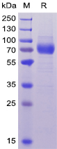 Human CD33 Protein, hFc-His Tag