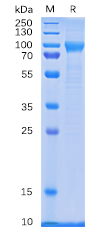 Human CD114 Protein, His Tag