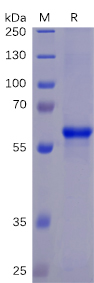 SARS-CoV-2 (2019-nCoV) S protein RBD, mFc-His Tag
