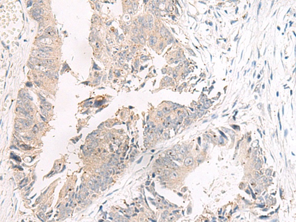 F5(Coagulation factor V light chain) Antibody