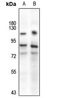 Anti-TAU Antibody