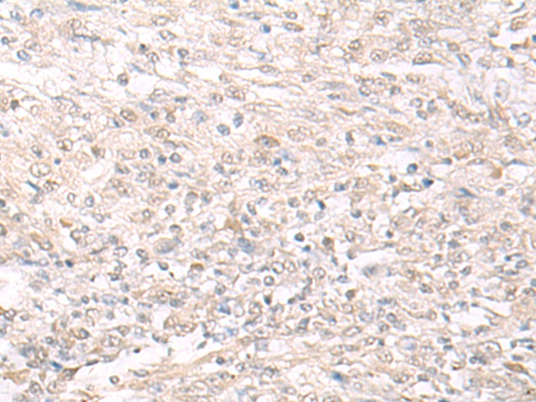 IL23A Antibody