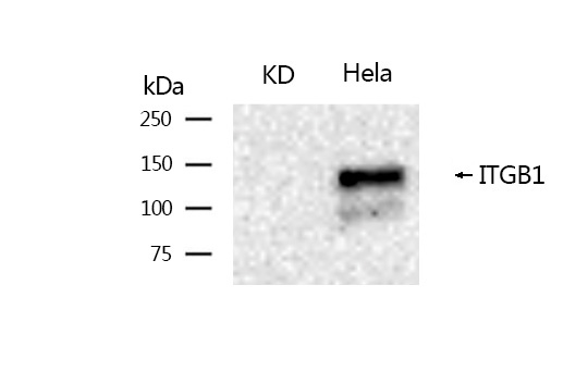 Integrin beta 1 Rabbit mAb