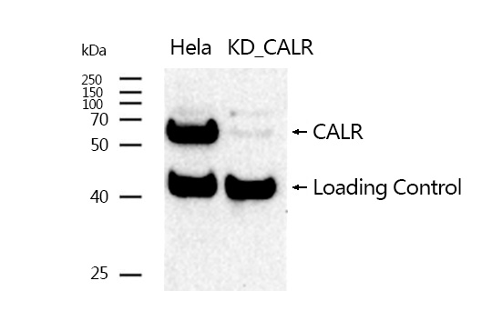 Calreticulin Rabbit mAb