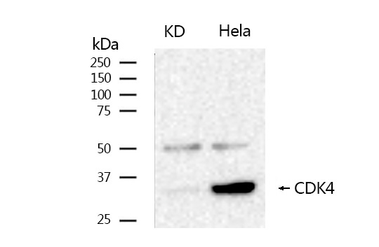 Cdk4 Rabbit mAb