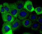 DSG1 Rabbit mAb