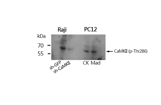 CaMKII(Phospho-Thr286) Antibody