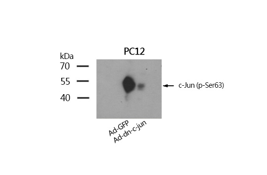 c-Jun (Phospho-Ser63) Antibody