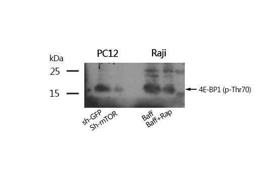 4E-BP1 (Phospho-Thr70) Antibody