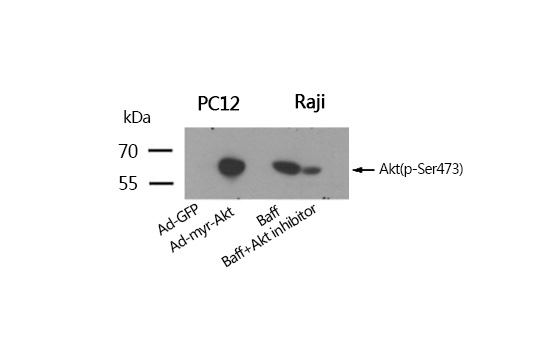 Akt(Phospho-Ser473) Antibody - SAB | Signalway Antibody