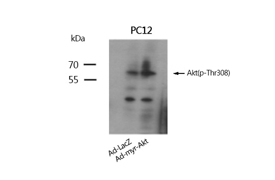 Akt(Phospho-Thr308) Antibody