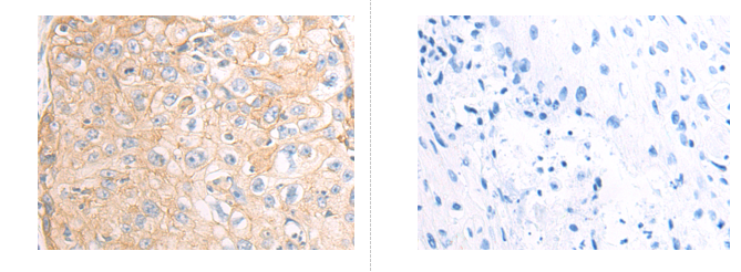 ITGB6 Antibody