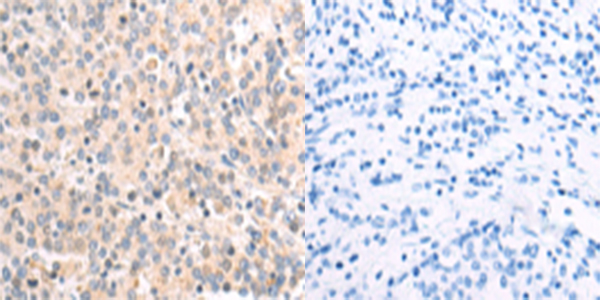 NDUFA1 Antibody
