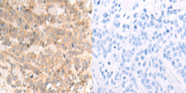NDUFA1 Antibody