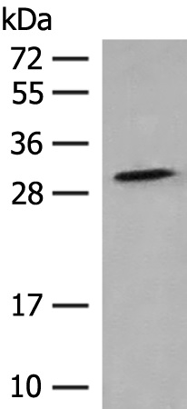 TACO1 Antibody