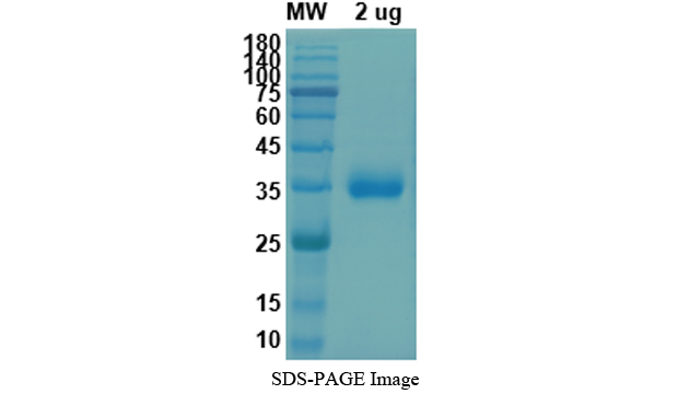 Recombinant 2019-nCoV S Protein RBD (Mammalian, C-His)