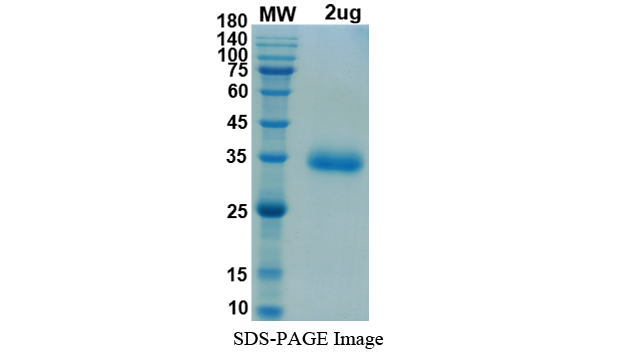 Recombinant 2019-nCoV S Protein RBD (K417T, E485K, N501Y, Mammalian, C-His)