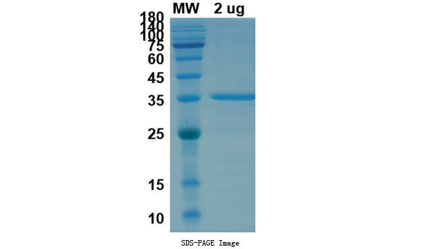 Recombinant 2020-nCoV S Protein RBD (L452Q, F490S, Mammalian, C-His)