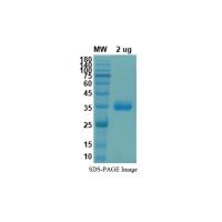 Recombinant 2019-nCoV S Protein RBD (Mammalian, C-His)