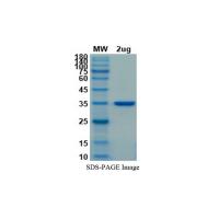 Recombinant 2019-nCoV S Protein RBD (K417N,L452R, T478K, Mammalian, C-His)