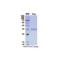 Recombinant 2019-nCoV S Protein RBD (L452R, Mammalian, C-His)