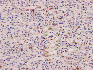 CD63 Rabbit mAb - SAB | Signalway Antibody