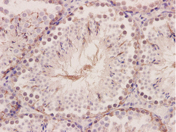 Integrin beta 3 Rabbit mAb