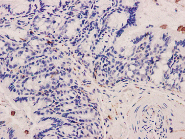 Integrin beta 3 Rabbit mAb